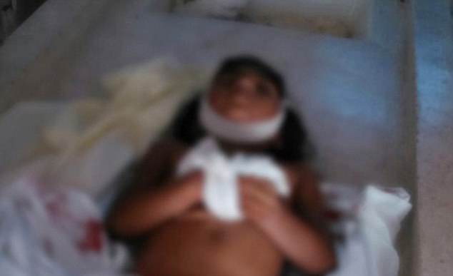 خورده شدن دختر ششساله توسط ماهیهای گوشتخوار خورده شدن دختر ششساله توسط ماهیهای گوشتخوار