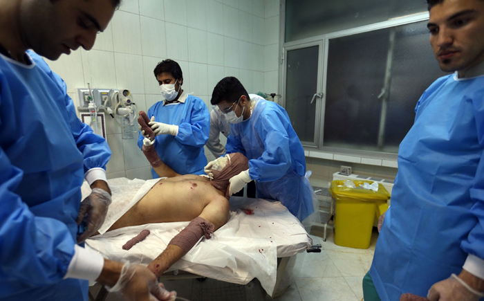 (تصاویر) مجروحان چهارشنبه آخر سال (تصاویر) مجروحان چهارشنبه آخر سال