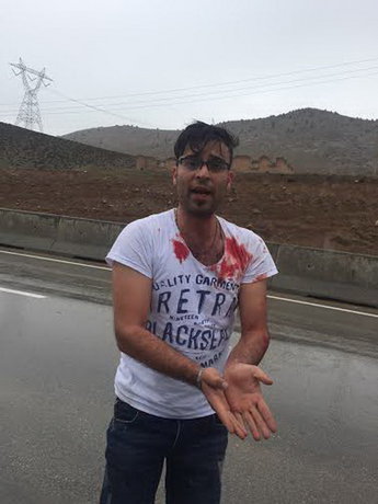 (تصاویر) واژگونی خودرو، بخاطر ایست پلیس (تصاویر) واژگونی خودرو، بخاطر ایست پلیس