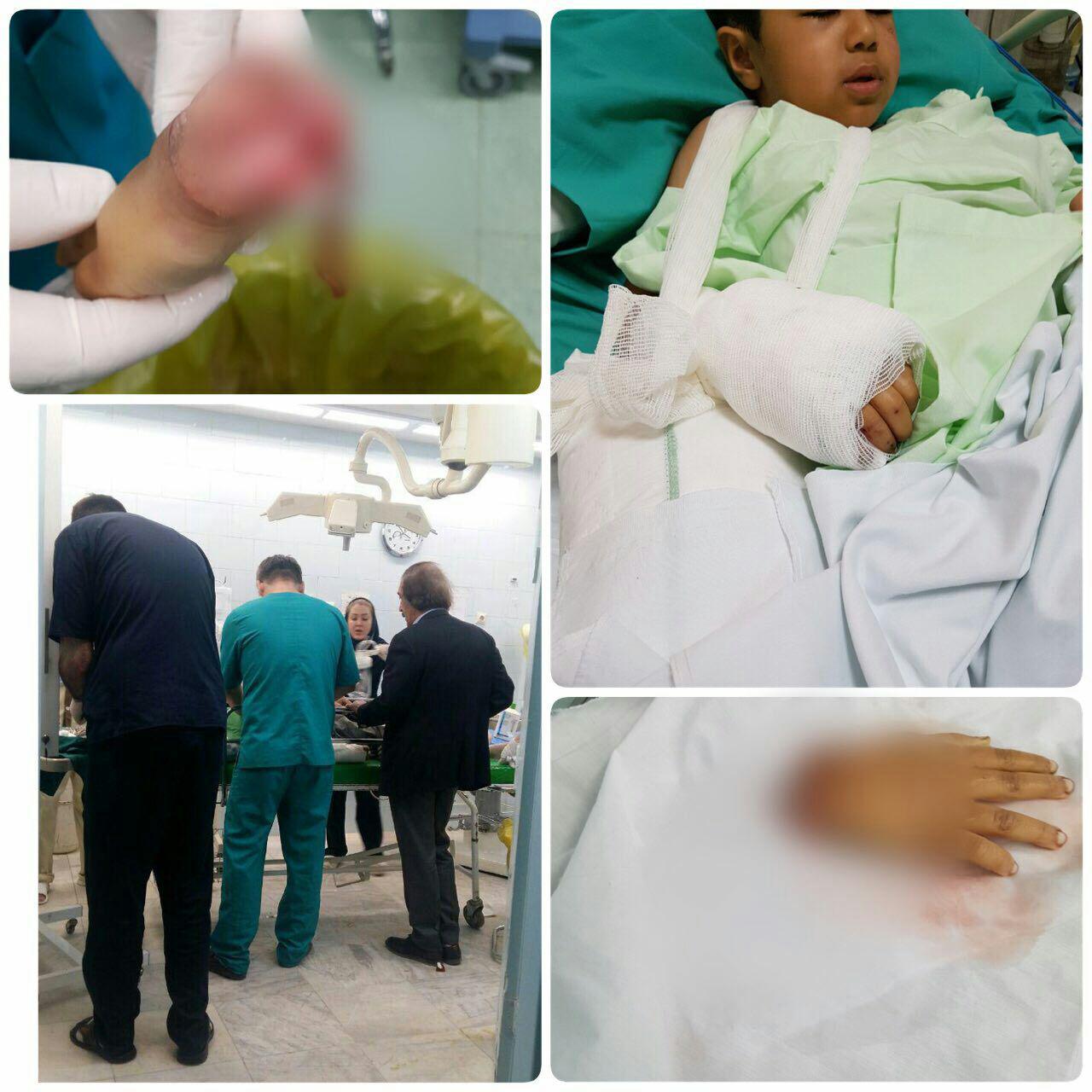 (عکس) پیوند دست قطعشده کودک زلزلهزده (عکس) پیوند دست قطعشده کودک زلزلهزده