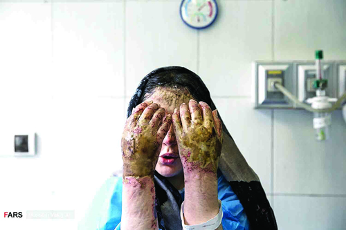گسترش حملات اسیدی در شمال غرب
