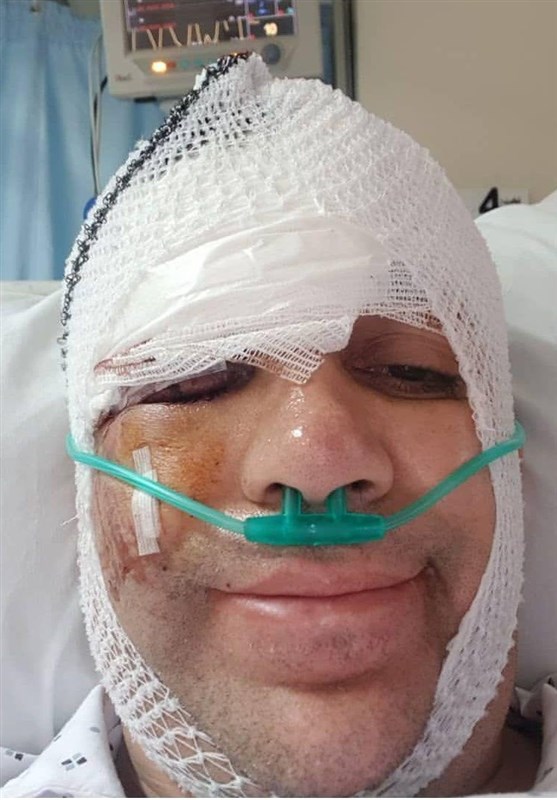 مصدومیت شدید امیر کربلایی‌زاده در تصادف با اتوبوس