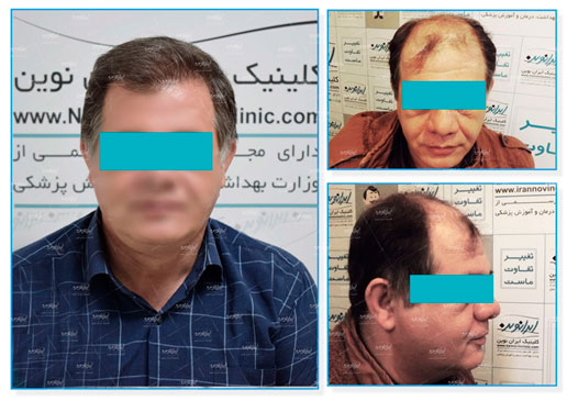 جشنواره ۷۷ روزه کلینیک پوست و مو ایران نوین آغاز شد