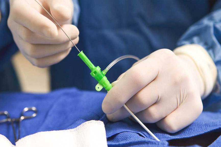 چگونه آریتمیِ قلب را کنترل کنیم؟ چگونه آریتمیِ قلب را کنترل کنیم؟
