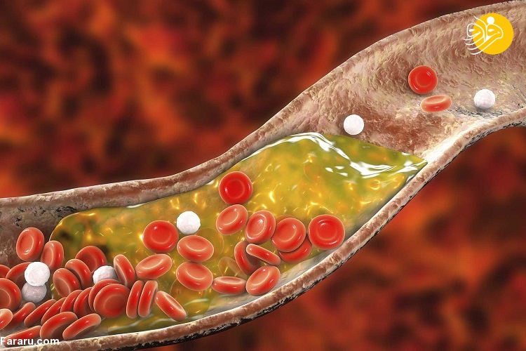 میزان کلسترول توصیه شده بر اساس سن میزان کلسترول توصیه شده بر اساس سن