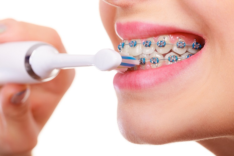 مسواک برقی برای چه کسانی توصیه می شود؟ مسواک برقی یا معمولی؛ کدام یک بهتر است؟