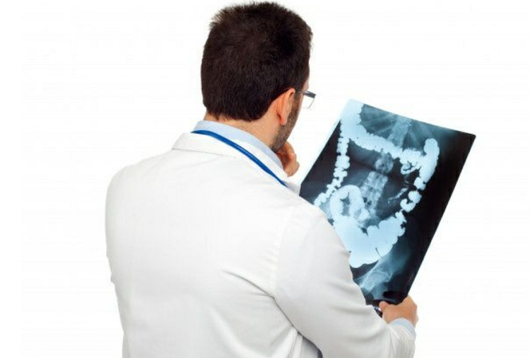 تشخیص سرطان روده بزرگ سرطان روده بزرگ؛ علت، نشانهها و راههای درمان آن