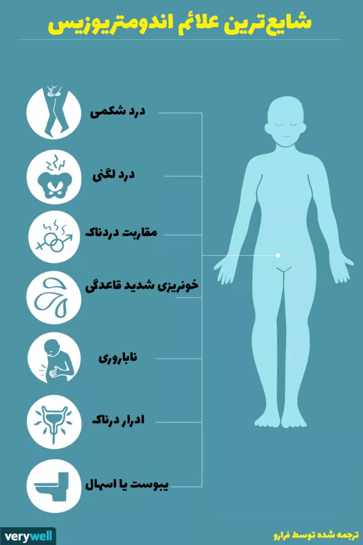 اندومتریوز و هرآنچه که باید درباره آن بدانید! علائم
