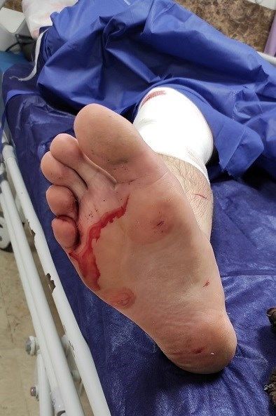 (تصاویر) جزئیات زورگیری خشن از عکاس خبری