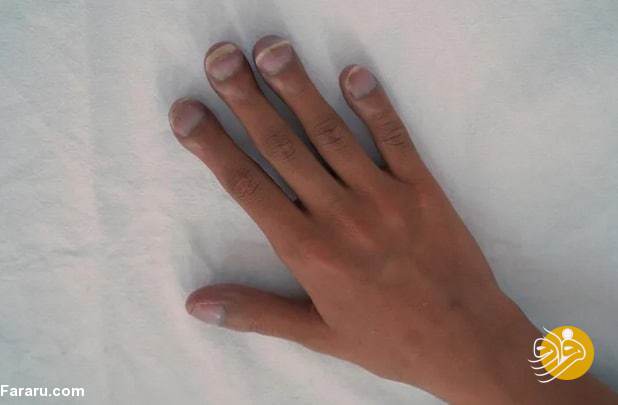 پنج نشانه‌ای که دستان شما می‌گویند مشکل قلبی دارید