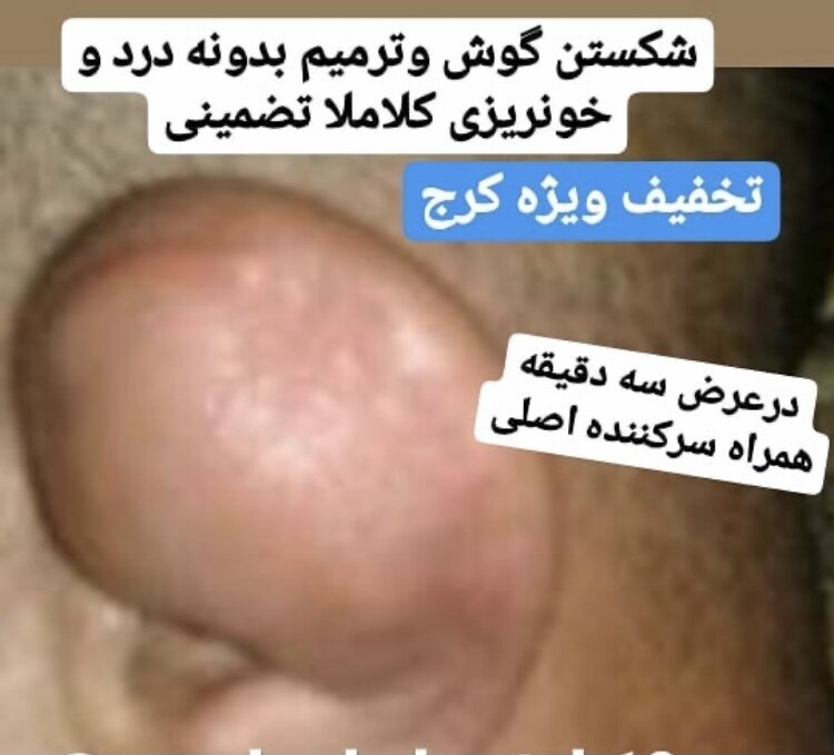 آگهی شکستن گوش