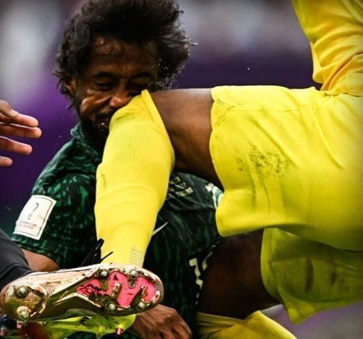 (تصاویر) اتفاق هولناک در بازی عربستان و آرژانتین