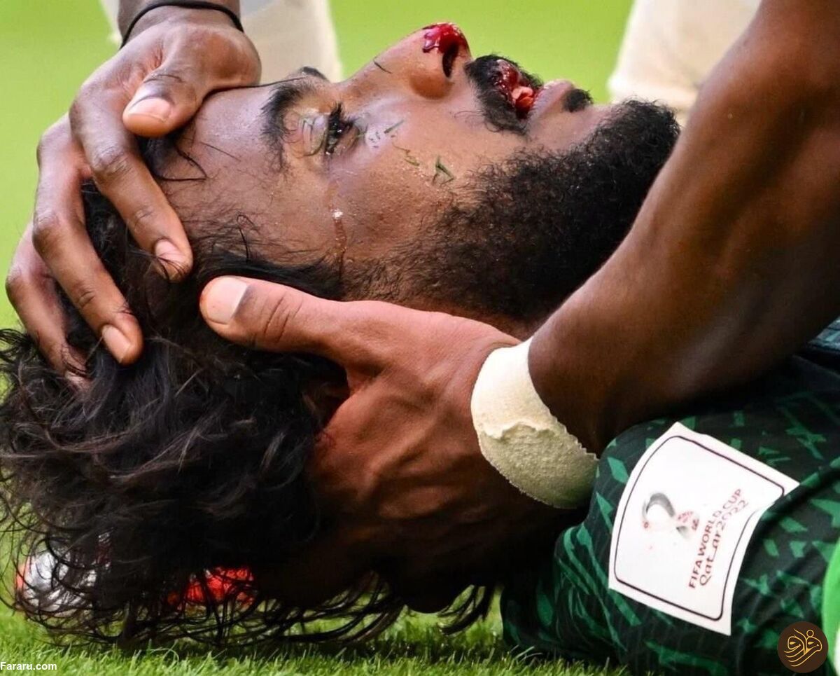 (عکس) جمجمه شهرانی خرد شد!