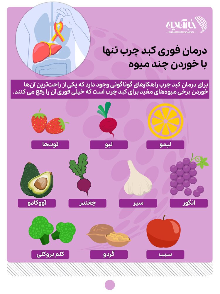 کبد چرب