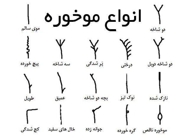 علت موخوره چیست؟/ قاتل موخوره و بهترین درمان موخوره را بشناسید