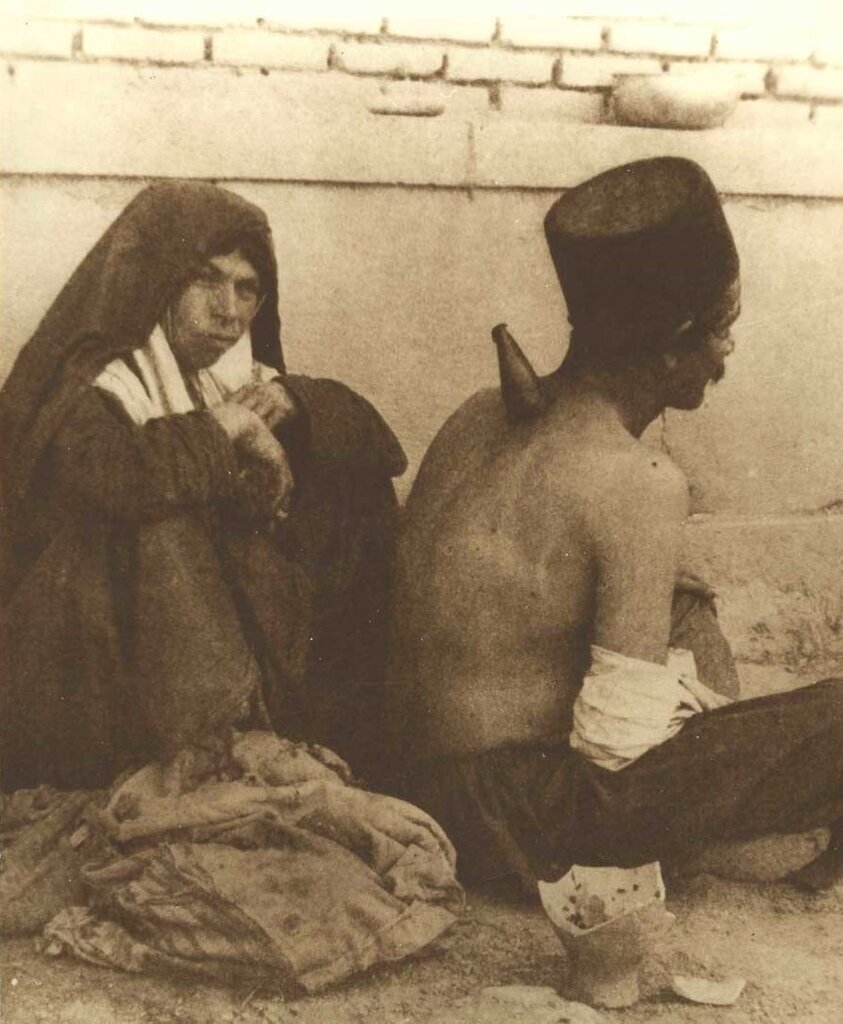 حجامت با شاخ گاو