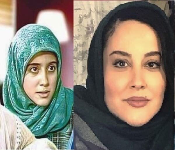 (تصویر) چهره خانم بازیگر پس از عمل جراحی