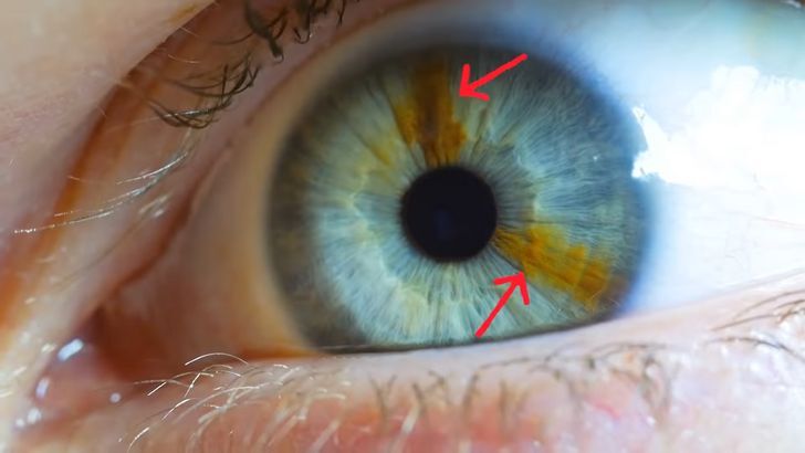 ۱۷ ویژگی نادر بدن که تنها در ۸ درصد انسان‌ها دیده می‌شود