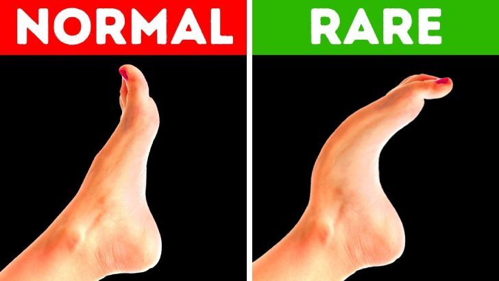 ۱۷ ویژگی نادر بدن که تنها در ۸ درصد انسان‌ها دیده می‌شود