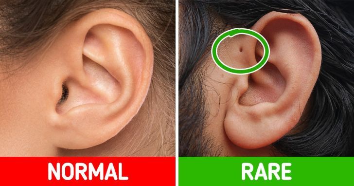 ۱۷ ویژگی نادر بدن که تنها در ۸ درصد انسان‌ها دیده می‌شود