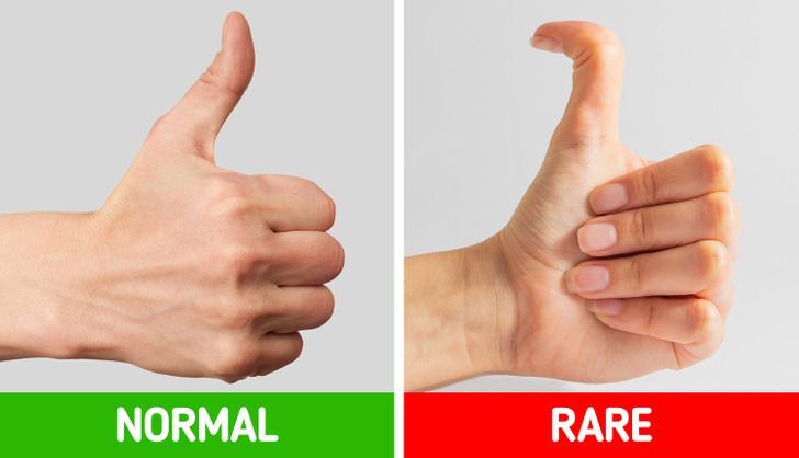 ۱۷ ویژگی نادر بدن که تنها در ۸ درصد انسان‌ها دیده می‌شود