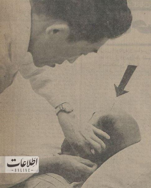 (عکس) اولین مشتری طب‌سوزنی در ایران که بود؟