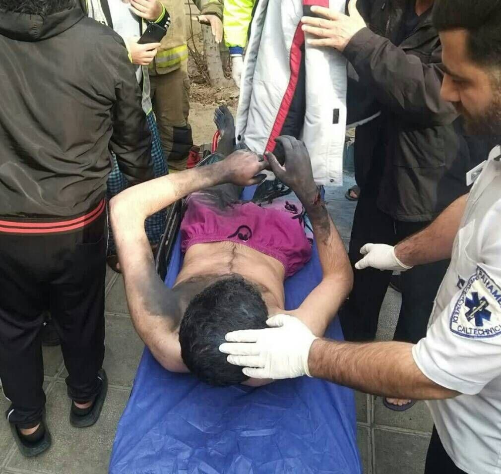 انفجار مواد محترقه در دست نوجوان ۱۶ ساله در پایتخت