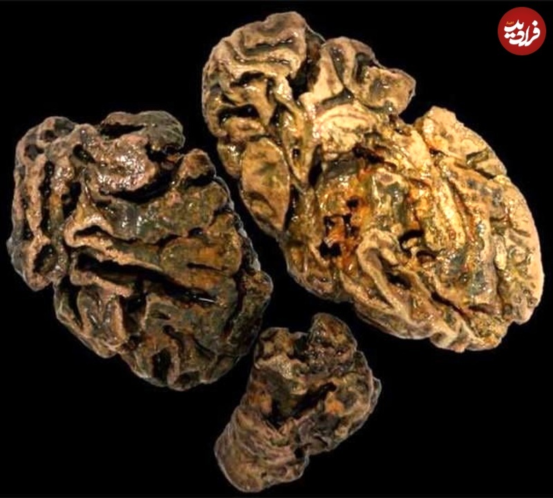 آیا «مغز» می‌تواند هزاران سال دوام بیاورد؟