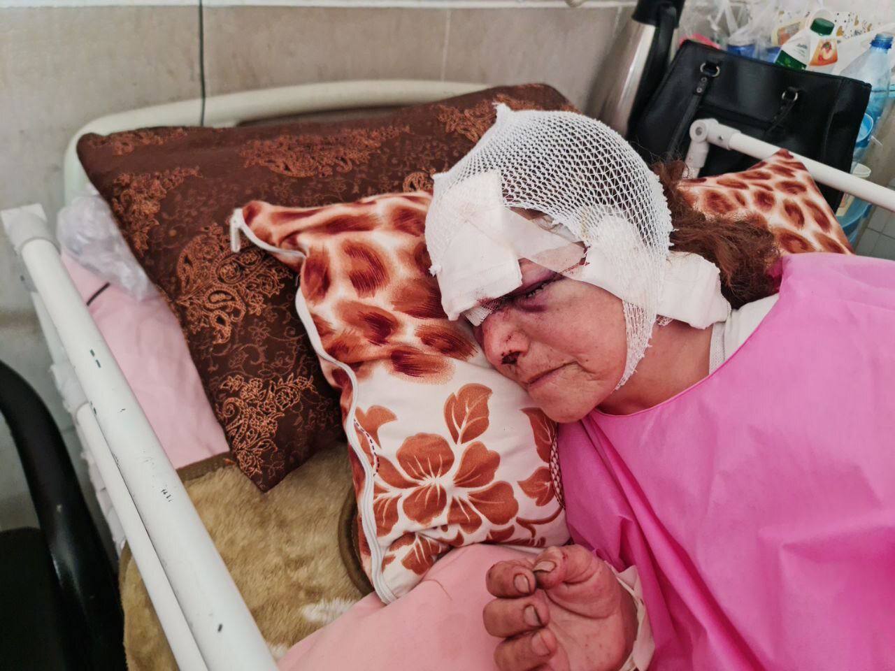 جدال زن ۶۰ ساله و خرس در ارتفاعات پیرانشهر