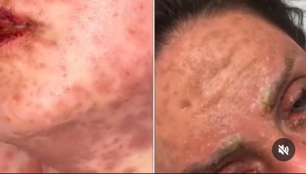 وزارت بهداشت: پزشکان عمومی تیغ زیبایی را زمین بگذارند!