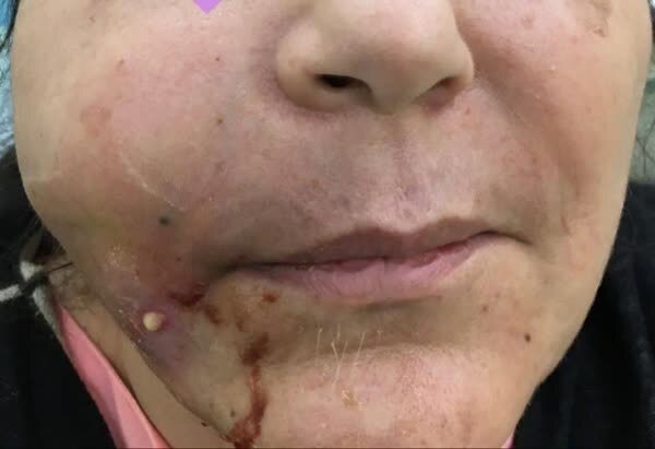 وزارت بهداشت: پزشکان عمومی تیغ زیبایی را زمین بگذارند!