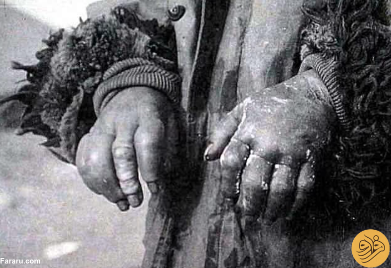 شیطانی‌ترین آزمایش‌های تاریخ؛ از بمب‌های طاعون ژاپن تا آزمایش‌های سیا برای کنترل ذهن