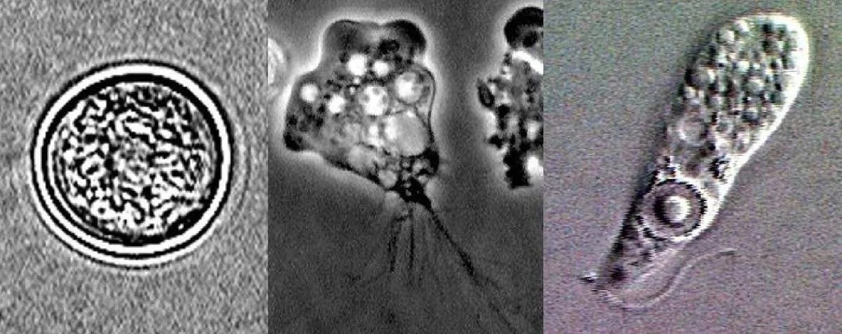 (تصاویر) از وبا تا آمیب مغزخوار؛ هفت بیماری ترسناک که ممکن است از آب بگیرید