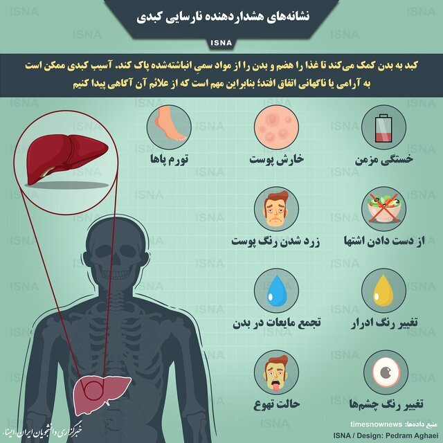 ۱۰ علامت و نشانه‌ ابتلا به کبد چرب