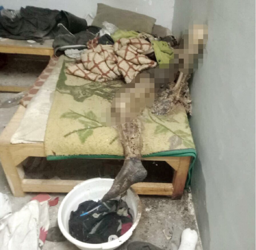 ماجرای تکان دهنده مردی که روی تختخواب اسکلت شد